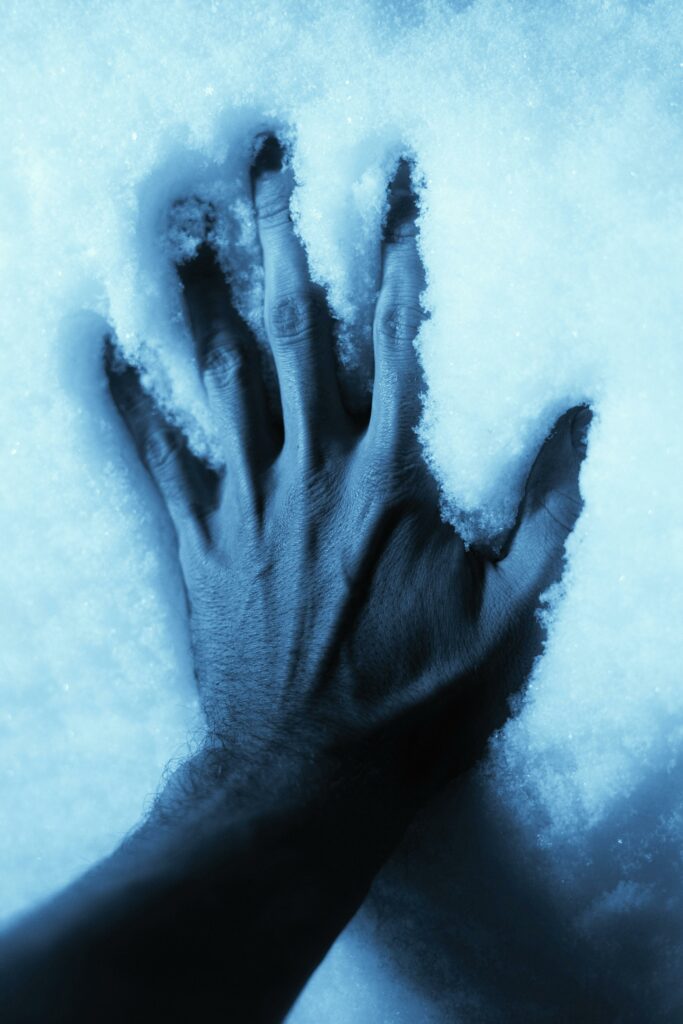 froid-hormones-naturopathe